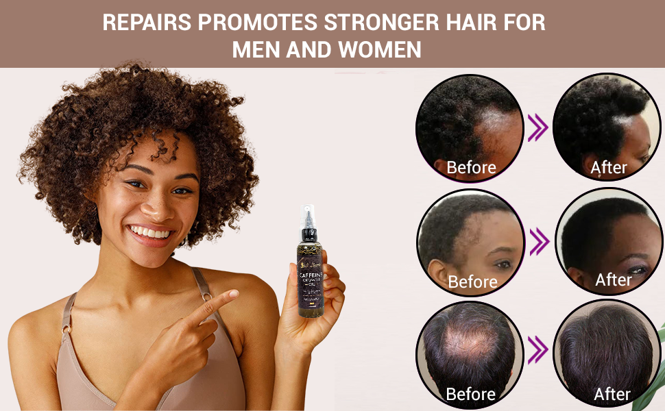 Caffeine Hair Growth Oil 4oz - Herbal Blend with Biotin & Essential